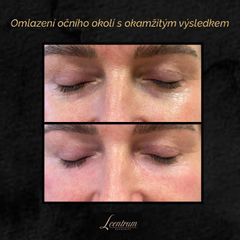 Facelift - MUDr. Drahomíra Kotlářová