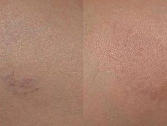 Laserová dermatologie - 724819