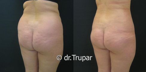 lipo boky1 kopie