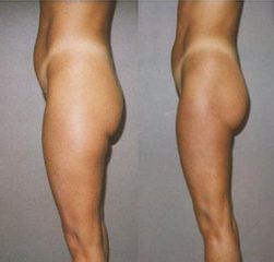foto1a