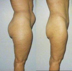 foto2a