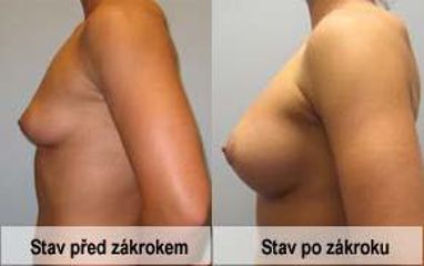 foto20a