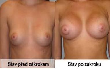 foto21a