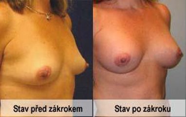 foto24a