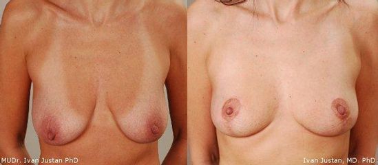 modelaceprsumala