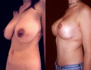 mod1