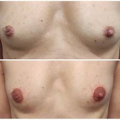 Mikropigmentace - MUDr. Klosová Hana Ph.D.