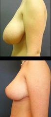 modelace2