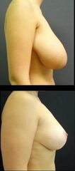 modelace3
