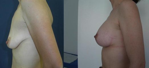 modelace 3