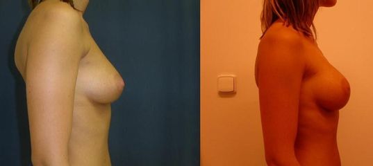 prsa 2