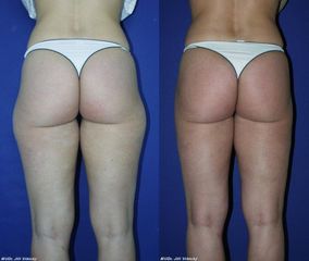 jez lipo z valy p 1
