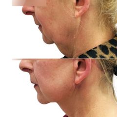 Myfacelift - MUDr. Pavel Kobzík