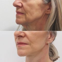 Myfacelift - MUDr. Pavel Kobzík