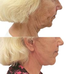 Myfacelift - MUDr. Pavel Kobzík