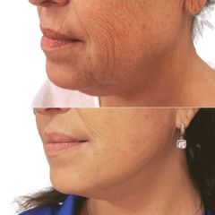 Myfacelift - MUDr. Pavel Kobzík