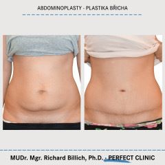 thumbnail_04_BILLICH_PLASTIKA_BRICHA_0125_POST_WEB_1500x1500_1