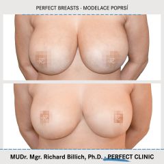 02_billich_modelace_0125_post_web_1500x1500_1