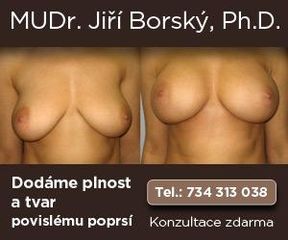 300x250 Borsky Prsa modelace2
