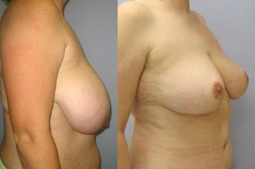 43B