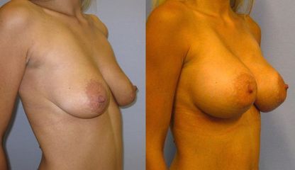 53B