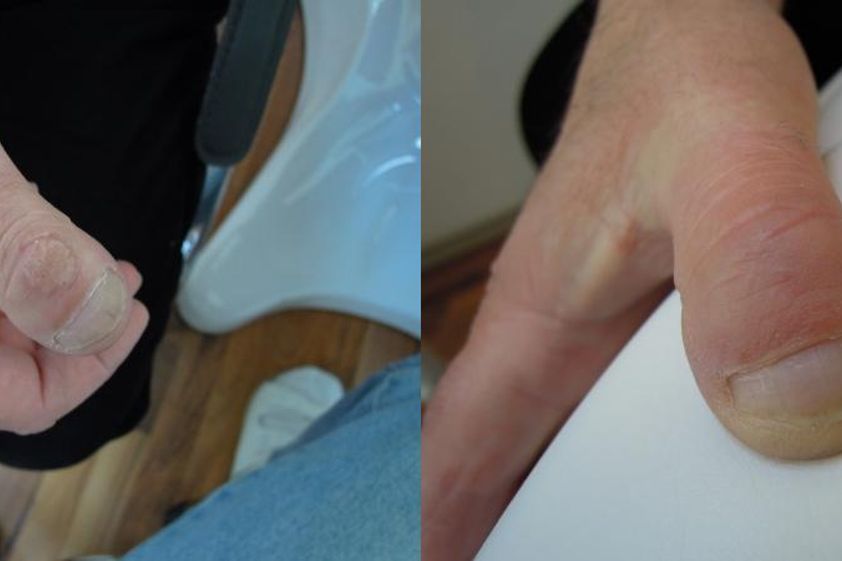 Laserová dermatologie před a po - 732595