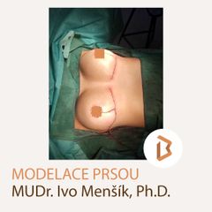 Body klinika plastické chirurgie