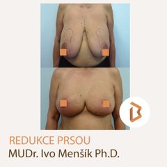 Body klinika plastické chirurgie