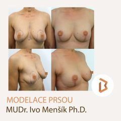 modelace prsou Kateřina Pavková