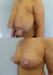 Body klinika plastické chirurgie