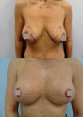Body klinika plastické chirurgie