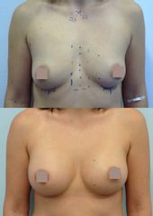 Body klinika plastické chirurgie