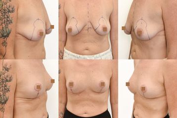 Body klinika plastické chirurgie