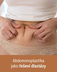 abdomino jako reseni diastazy