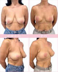 Body klinika plastické chirurgie