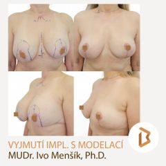 Body klinika plastické chirurgie