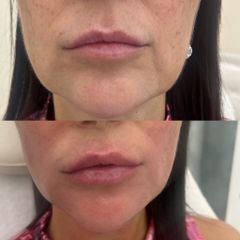 Anti Aging - MUDr. Monika Manderlová