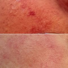 Laserová dermatologická - Amaryllis Centrum Praha