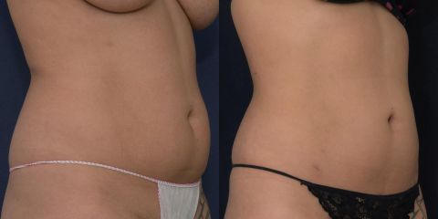 DSC 4688 1