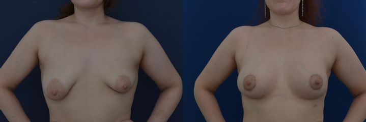 DSC 6899
