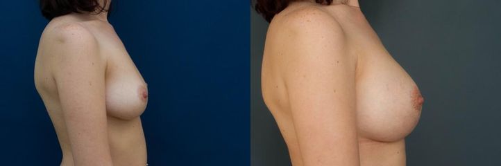  DSC2265