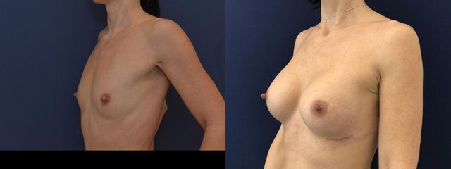 DSC 7721