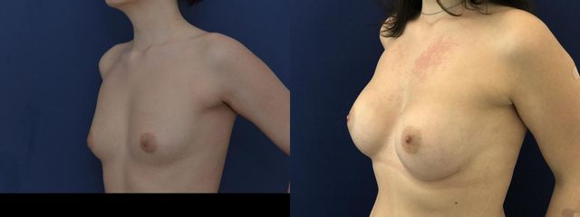 DSC 6445