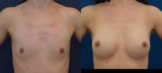 DSC 8052 1