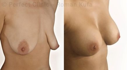 novaAug 2ab