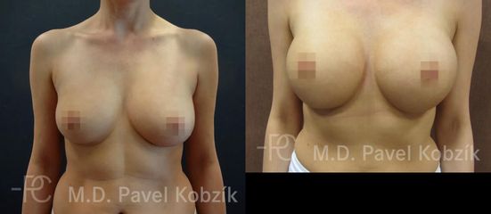 Pred I kobzik