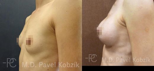 Pred II