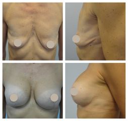 MUDr. Hana Zimovčáková - BODY klinika plastické chirurgie