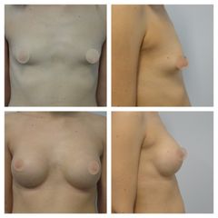 MUDr. Hana Zimovčáková - BODY klinika plastické chirurgie