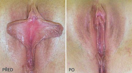 LABIO 2464